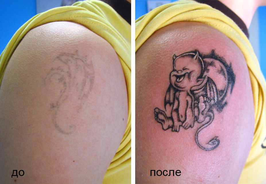 Коррекция Татуировки до и после